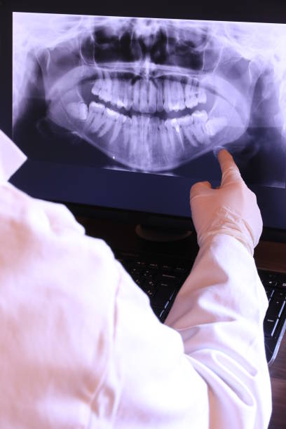 Best Emergency Root Canal Therapy in Ludlow, KY